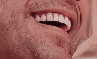 His Teeth #30DaysToSidharthsBday