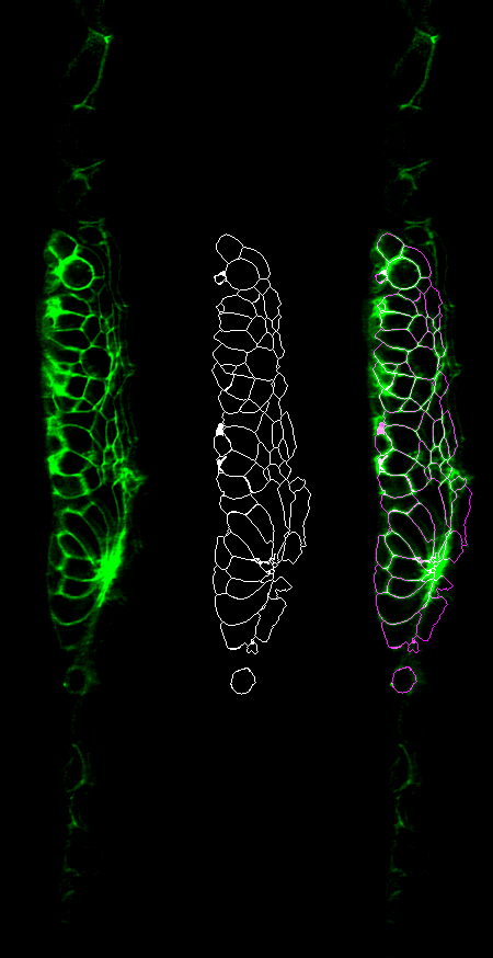 A common first step for us is instance segmentation of cells in our tissue. The segmentation itself is pretty straightforward, and runs in python using jupyter notebooks. And it works pretty well -- here is original, segmented and overlay. But, there are problems.