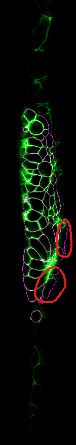 The first problem is that some parts of the background or surrounding tissue get segmented, for instance the circled parts here. Also we sometimes miss or fuse cells in the internal structure of the tissue.