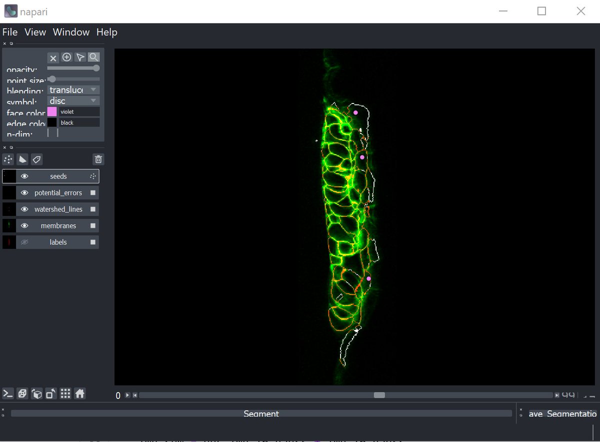 We generate a napari viewer, importing the original image (green), the segmentation (red), the seed points (purple) and a calculated segmentation "confidence" image (white). (Apologies to  @Red_Green_Cow)