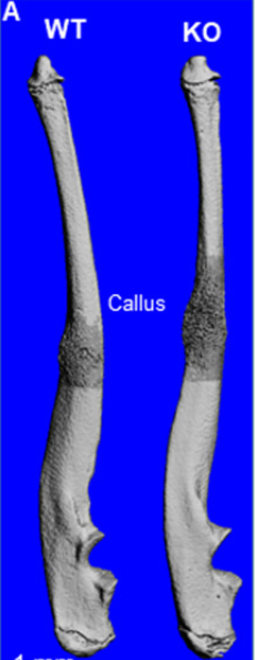 washu_ortho_res's tweet image. New paper online in Bone by recent Silva lab graduate Brandon Coates, PhD @bcoates52 , with unexpected finding that mice lacking IL6 form a larger callus after stress fracture.  authors.elsevier.com/a/1c3YlV6zM96w…
@Els_ENDO  @asbmr  @wustlcrm  @WashUBME  @Ors
