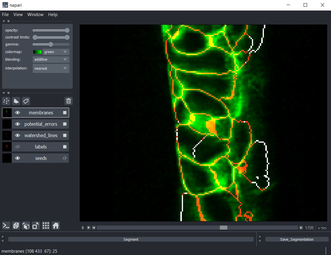 Even difficult errors, like this one near the middle, are easy to see in the viewer. Here a cell has erroneously been assigned two seed points due to a very amorphous nucleus.