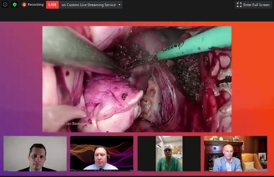 AppliedMed_GYN's tweet photo. Visualization 💯. Impressive approach to this large uterus by Dr. Jan Baekelandt. #vNOTES #AAGL20 https://t.co/AfQP1LMtEJ