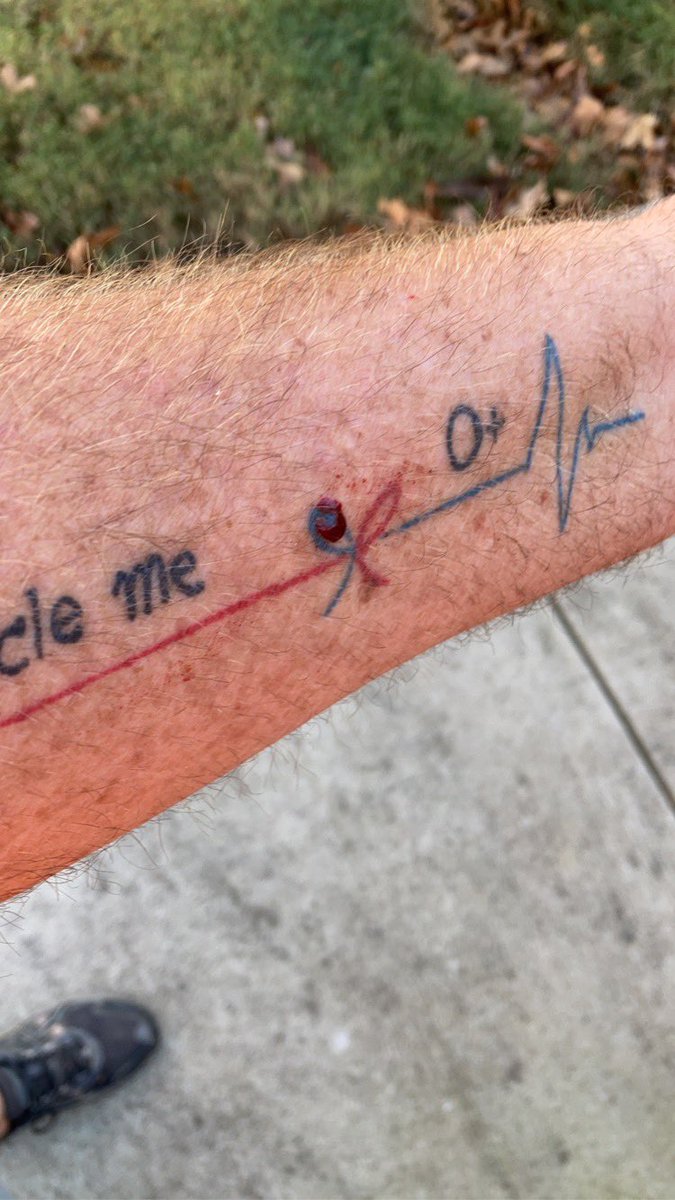 KurtBauche's tweet photo. Is it bad karma to cut yourself on top of your organ donor tat? #nothumerus #ulna https://t.co/4vj8755EgD