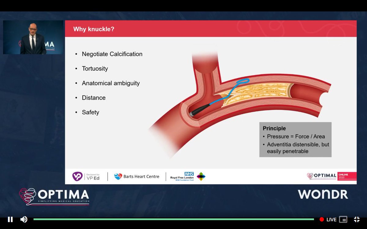 What an amazing day 4  @OptimaCTO fantastic talks & great live cases. Thank you very much  #optimalonline2020 for incredible 4 days of education. Learnt so much & looking forward to more  @jcspratt  @KambisMashayek1  @RinfretStephane  @mbmcentegart  @SmithElliotjs  @kevinjamescroce