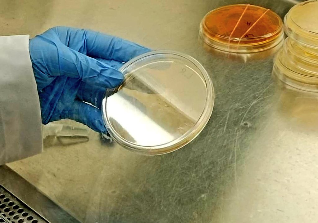 SanjitaPanigra2's tweet image. Diary Microbes.
#labdiaries