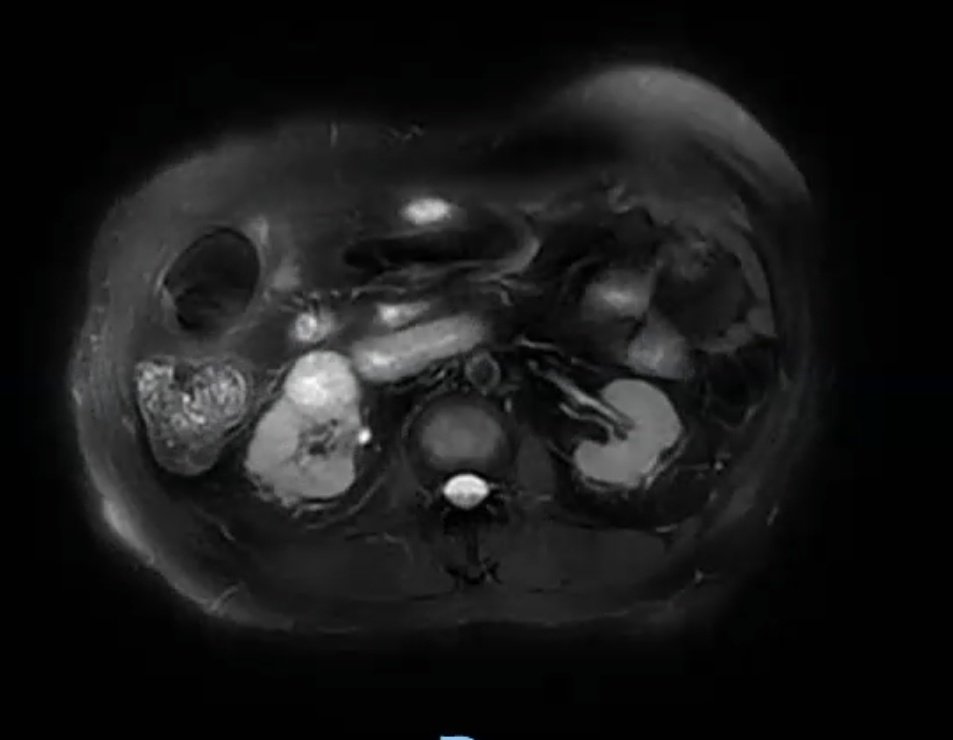 Urología Hospital Juárez de México 🇲🇽 tweet media