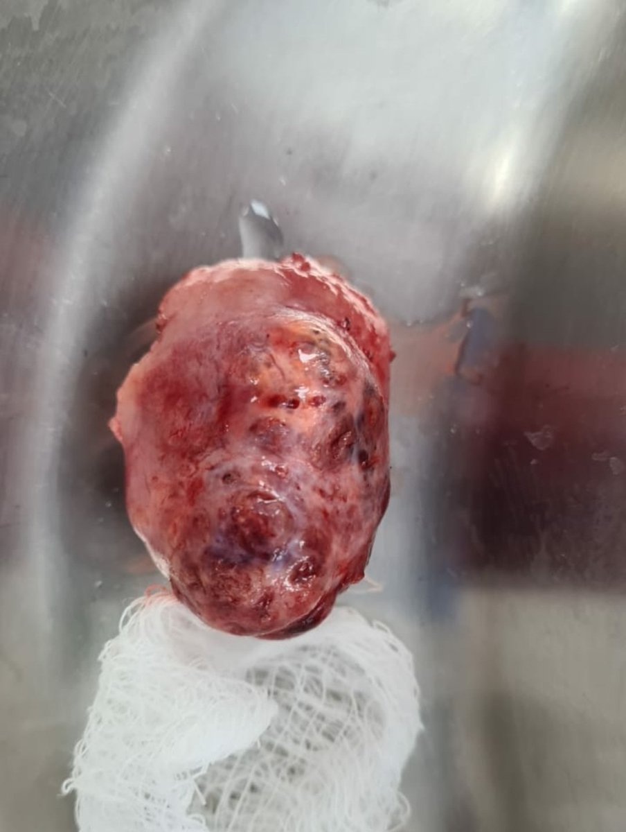 Urología Hospital Juárez de México 🇲🇽 tweet media