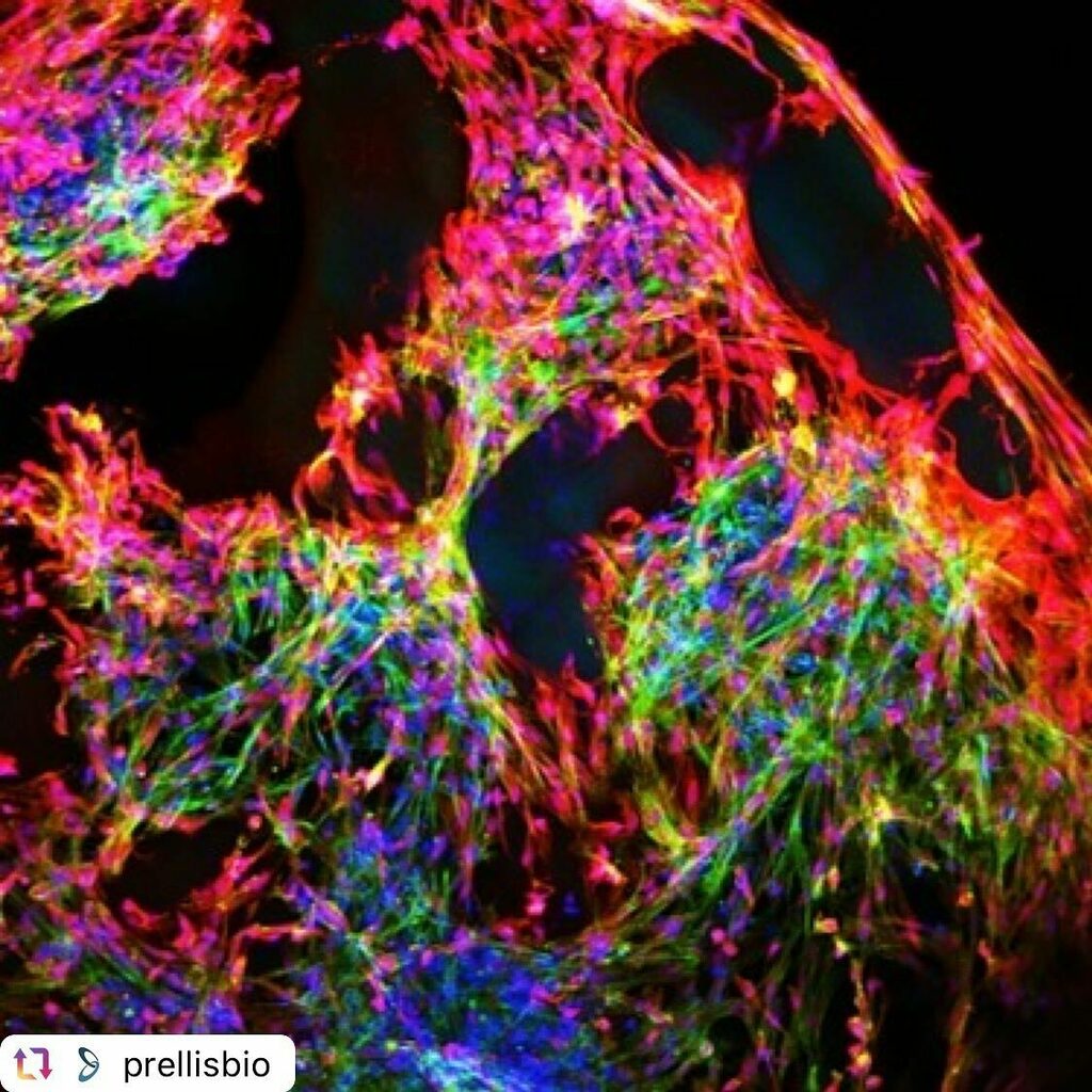 3dheals's tweet photo. #Repost @prellisbio
.
Prellis CEO and Founder, Dr. Melanie Matheu, writes, “While moving several human antibody candidates forward in IND enabling studies (#sarscov2) we haven't forgotten our #3dtissue #engineering and will be excited to share updates soon.” (Image descript… https://t.co/YLjF6eYr25