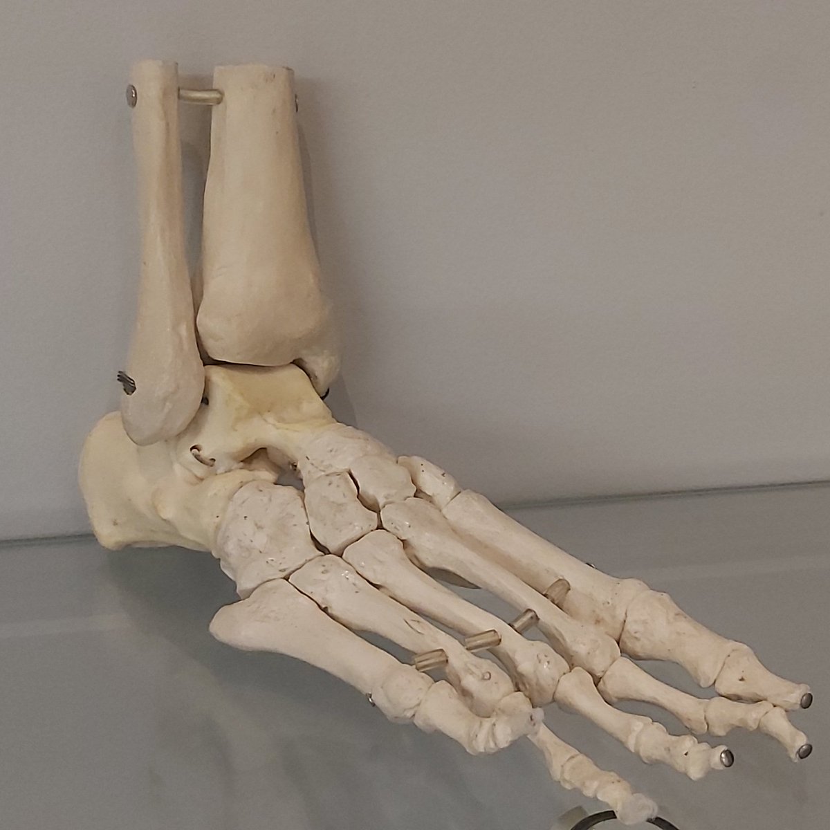 BowValleyChiro's tweet photo. Did you know 1/4 of the body's bones are in the feet?
With so many bones in the feet, it is important to keep
them supported with #customorthotics! Make your appointment today 403.262.2211 or email us
at admin@bowvalleychiro.com #orthotics #downtowncalgary #northeastcalgary https://t.co/HY47KAFO41