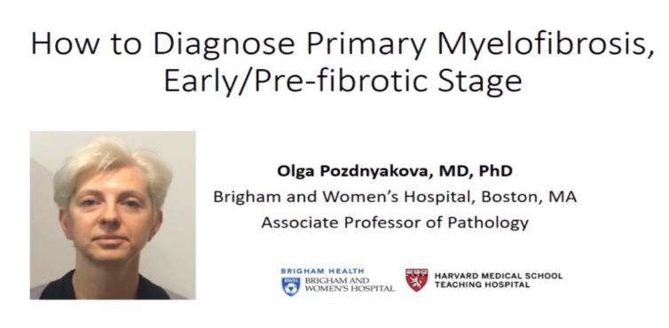 Our most recent #SocHemepath video tutorial features Dr. Olga Pozdnyakova from Brigham and Women's Hospital showing 'How to Diagnose Primary Myelofibrosis, Early/Pre-fibrotic Stage' This video is free to the public on our website: bit.ly/3lsol01 #hemepath #virtualpath