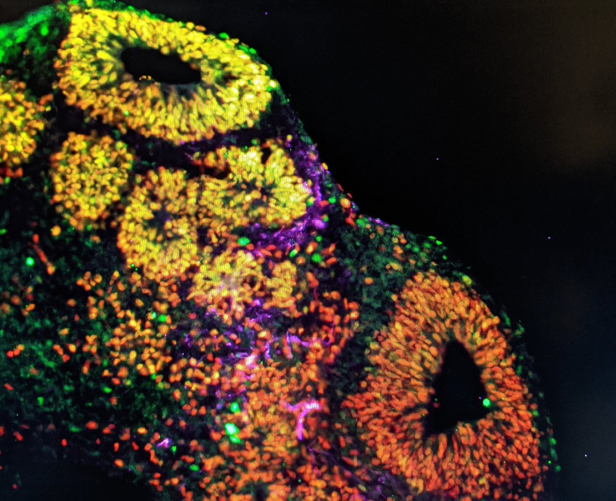 NicoleFGreen's tweet photo. Have a look at my photo for the image competition for #2020EAPS on the Whova app and vote for it!
It's a photo of a brain organoid from the #2020SHBOW earlier this year and my favourite photo I've taken during my PhD https://t.co/pMJk0pQae7