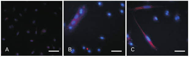 AcbjournalO's tweet photo. Role of cerebrospinal fluid in differentiation of human dental pulp stem cells into neuron-like cells

https://t.co/29AL03I9xo
Anat Cell Biol 2020; 53(3): 292-300
#대한해부학회 #AnatomyCellBiology 
#CerebrospinalFluid #CellTransdifferentiation #Alzheimer #HumanDentalPulpStemCells https://t.co/Q7oxO4Vbk1
