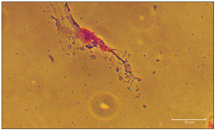 AcbjournalO's tweet photo. Role of cerebrospinal fluid in differentiation of human dental pulp stem cells into neuron-like cells

https://t.co/29AL03I9xo
Anat Cell Biol 2020; 53(3): 292-300
#대한해부학회 #AnatomyCellBiology 
#CerebrospinalFluid #CellTransdifferentiation #Alzheimer #HumanDentalPulpStemCells https://t.co/Q7oxO4Vbk1