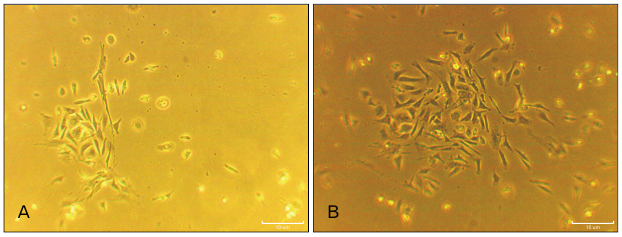 AcbjournalO's tweet photo. Role of cerebrospinal fluid in differentiation of human dental pulp stem cells into neuron-like cells

https://t.co/29AL03I9xo
Anat Cell Biol 2020; 53(3): 292-300
#대한해부학회 #AnatomyCellBiology 
#CerebrospinalFluid #CellTransdifferentiation #Alzheimer #HumanDentalPulpStemCells https://t.co/Q7oxO4Vbk1