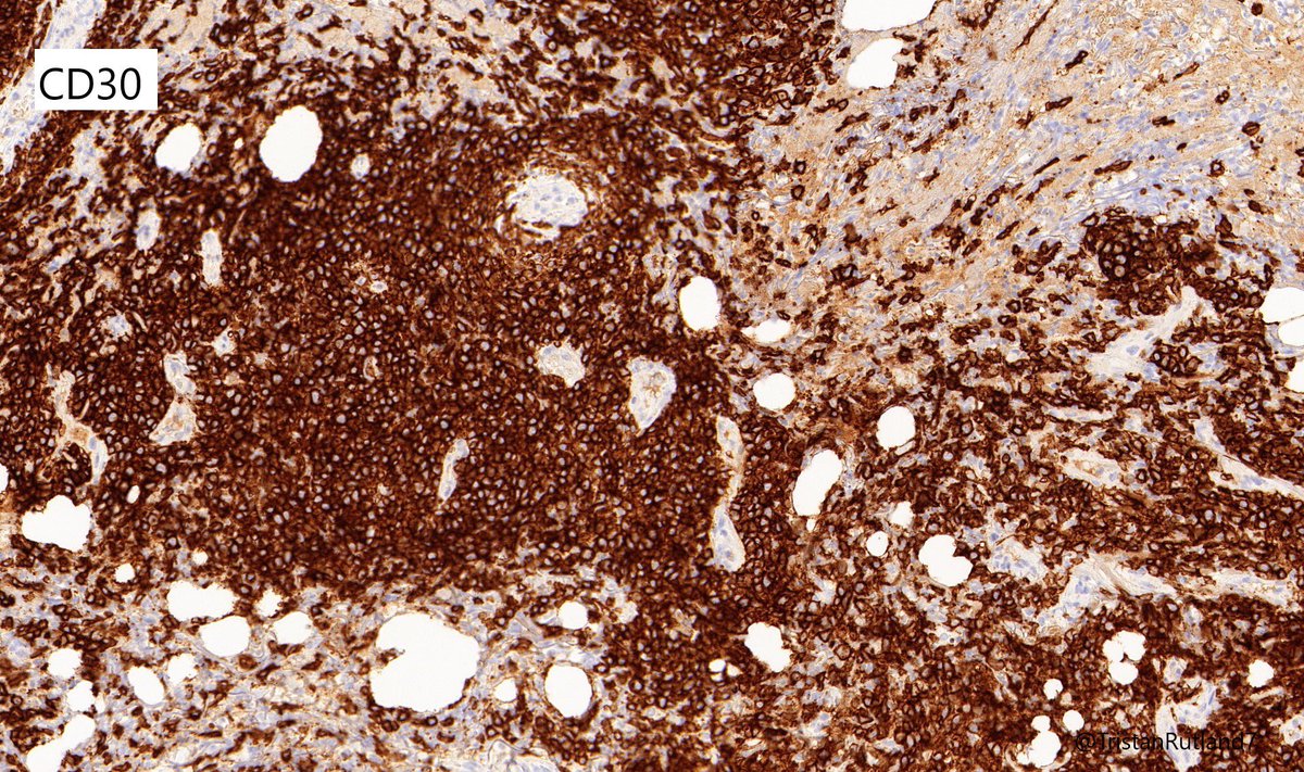 CD30