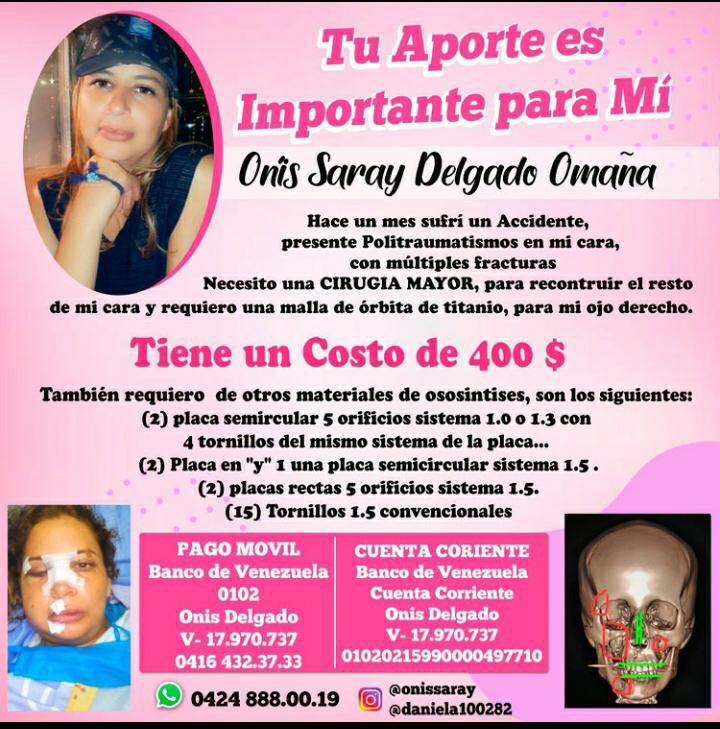 Familia y allegados de Onis Saray , me solicitaron subir su campaña para lograr reconstruir parte de su cara , luego de sufrir un aparatoso accidente . Gracias por sus RT’S