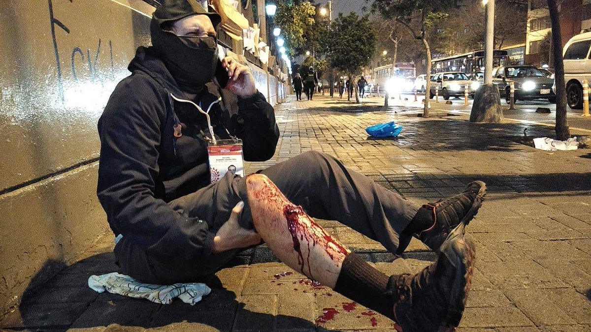 URGENTE. Periodista de Ojo Público, Alonso Valbuena es herido con una lacrimógena.
<a href="/Almagro_OEA2015/">Luis Almagro</a>
<a href="/OEA_oficial/">OEA</a>
<a href="/ONU_derechos/">ONU Derechos Humanos - América del Sur</a>
<a href="/ONU_es/">Naciones Unidas</a>
<a href="/CIDH/">CIDH - IACHR</a>
<a href="/CNNEE/">CNN en Español</a>
<a href="/Defensoria_Peru/">Defensoría del Pueblo</a>
<a href="/TC_Peru/">Tribunal Constitucional del Perú</a>