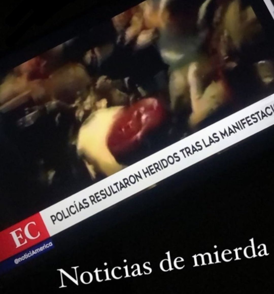 msfritaa's tweet photo. Y los manifestantes que fueron heridos por bombas lacrimógenas, perdigones, gas pimienta y demás que se vayan a la mierda. PRENSA VENDIDA https://t.co/jNDK7puJ2u