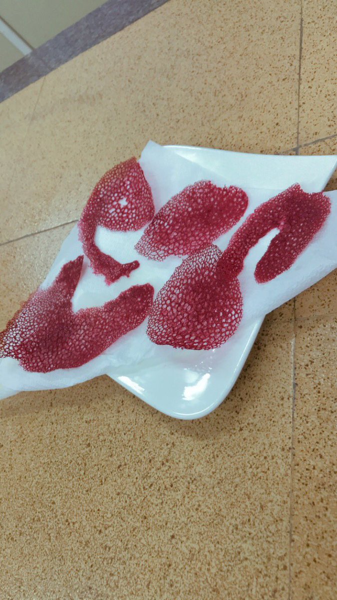 ChefSegzy's tweet photo. All work and no play makes chef a dull chef 😆,CORAL TUILE, Got a new garnishing #cheflife #chefsofinstagram #chefsworldtv #cheflife🔪 #chefchioma #chefs #chefstone #chefsplate #chefstalk #chefswords #chefstyle
#67kitchen https://t.co/tzcQ1l84oN