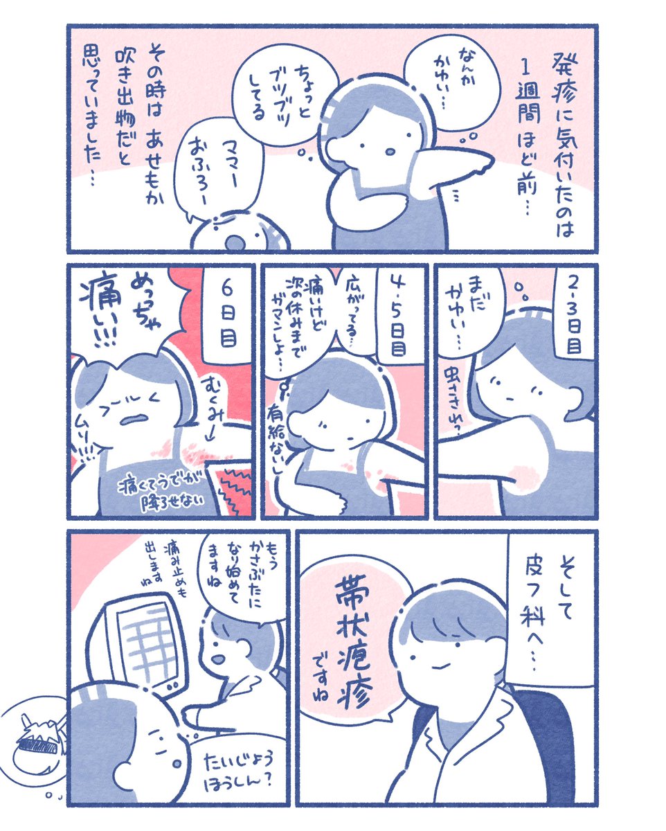 帯状疱疹になりました。。水ぼうそうにかかっていない子どもにうつる可能性があるそうなので、お医者さんに聞いたことをまとめてみました。
もしかして…と思ったら一緒におフロは避けた方がいいかもしれません〜 