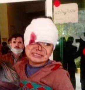 YasminMir0's tweet photo. Where is United Nation where Is OIC May Allah distroye India
#Kashmirbleed
#NelumVellyAJk😭💔 
#RipUNO
#RipOIC
#PakistanArmy https://t.co/qUlk38qWUP
