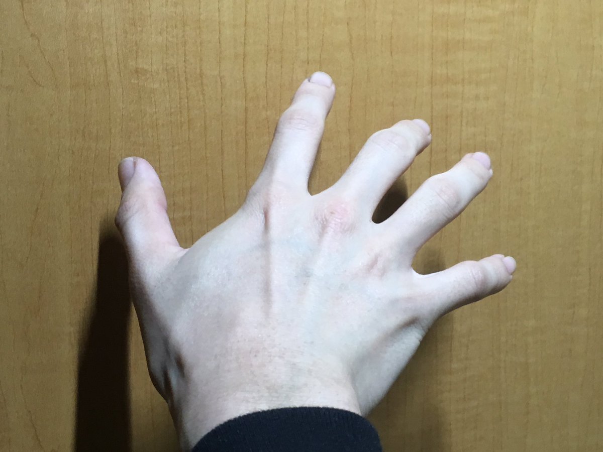 ス ッキヰ ライティングの関係で血色悪い妖怪みたいになった僕の手見て ス ッキヰ ライティングの関係で血色悪い妖怪みたいになった僕の手見て
