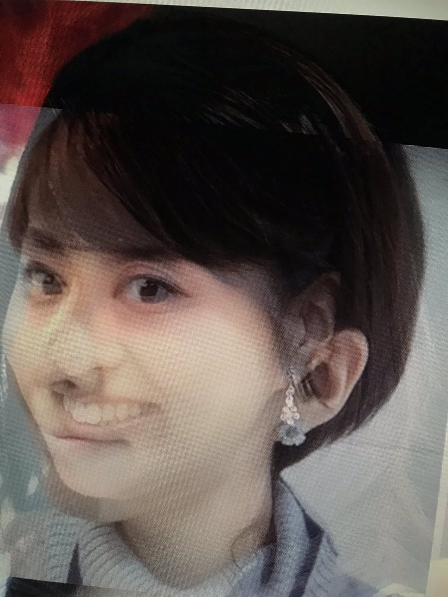 DBwiSVhVvoU9IuA's tweet photo. おそらく、たくさんの人がモヤモヤしてい��と思う #小林麻央 について検証してみました。
入院前と入院後の写真を重ねてみると、顎のラインがかなり違います。
入院後は顎全体が奥に引っ込んでいる感じです。

また、斜めからのアングルだと耳の位置が明らかに違います。
（続く） https://t.co/auoW7I6vOC