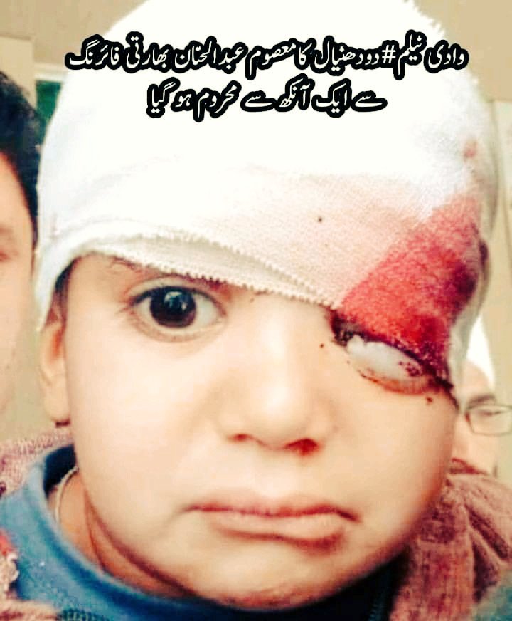 AKF__Official's tweet photo. FOUR civilians, including woman, martyred and 22 injured in #NeelumValley, 4 in #Panjkot area of #Muzaffarabad and 1 in #Reshian, #LeepaValley in today's #IndianShelling. @RSSorg @narendramodi killed our innocent civilians out of frustration. #IndiaIsTerrorist. @the_hindu @WSJ https://t.co/I2NVRuhKca