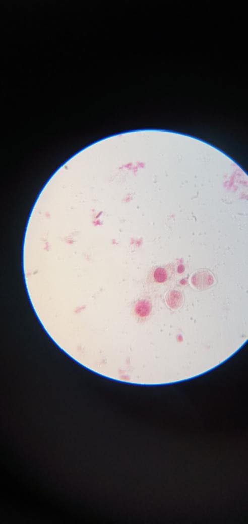 Zxaffar's tweet photo. Hand made temporary slides showing different stages of M phase of cell cycle prepared from the flower buds of #Papaver and #Allium.
#Prophase
#Anaphase1
#Anaphase2
#Telophase
#Tetrad stage https://t.co/Pp7xRcerQj