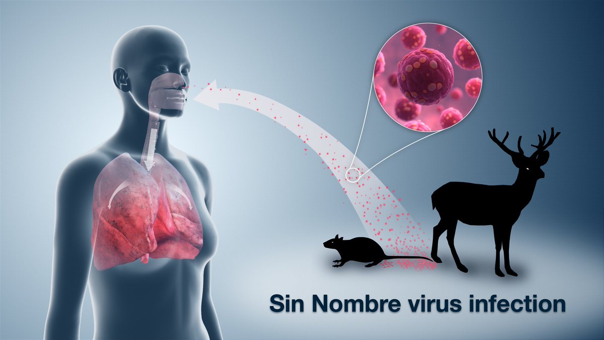 The next proposal was to call it "Four Corners" virus. The larger communities in the region *also* objected. Loss of business, tourism, and just a general stigma were cited.Frustrated, the viral taxonomists designated it "Sin Nombre orthohantavirus", the virus without a name.