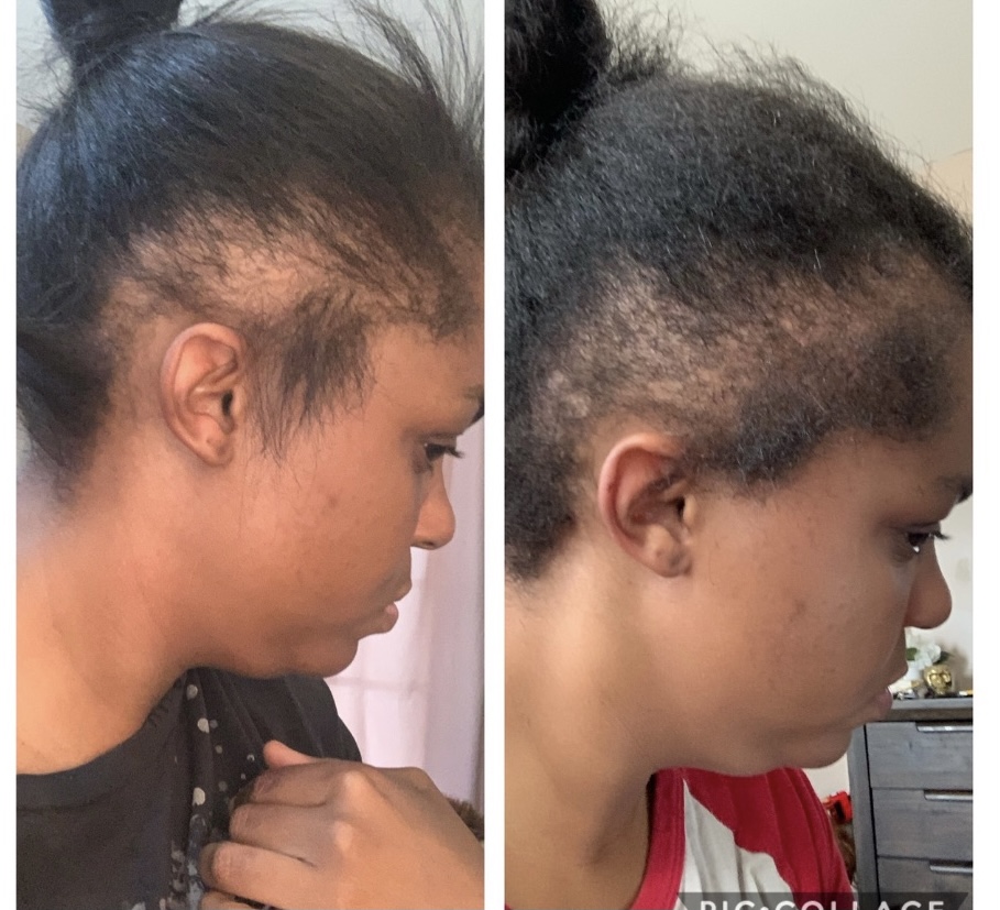 Zingi Organics on Twitter "Results from our zingi organics hair kit