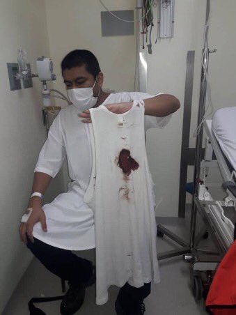 this ball was shot from the police to Alonso Chero, photographer from national newspaper “El Comercio”, while he was doing his work. almost at the same time, the interior minister said that police were only shooting tear gas bombssource :  @mal_menor