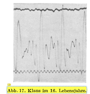 This figures is titled "Klaus at age 16." I can only imagine his wife asked him if it would kill him to put up some pictures of his kids in his office or something. Thanks dad! 13/N