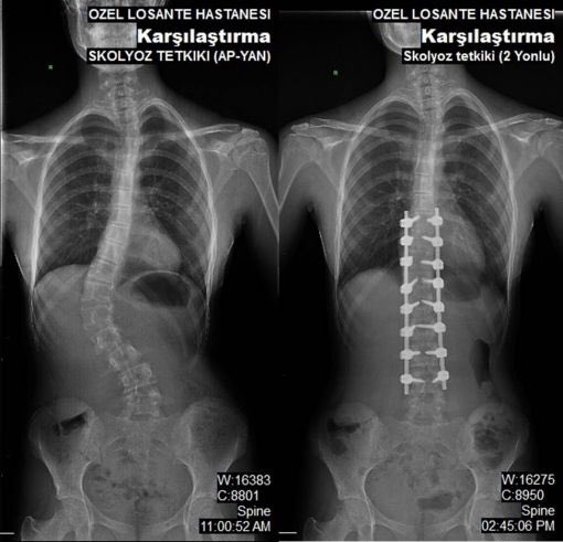 Harikalar yaratan doktorlarımız ve OMURGA CERRAHİSİ DANIŞMA KURULUMUZ 
Lösante Hastanesinin gururudur