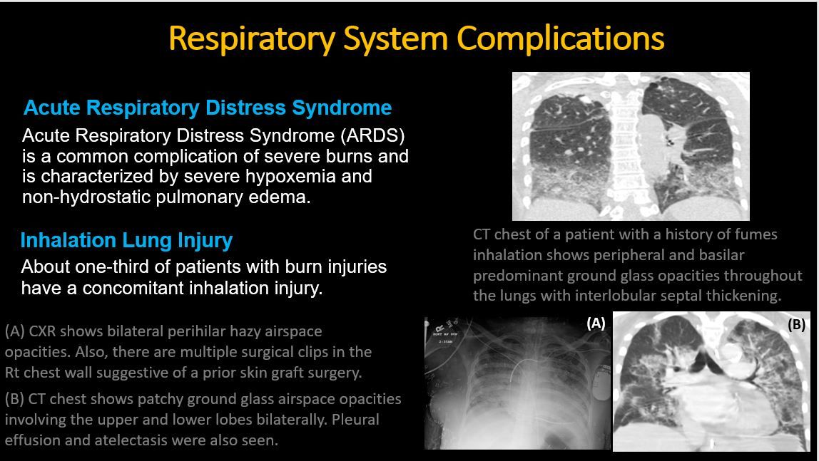 American Society of Emergency Radiology | ASER tweet media