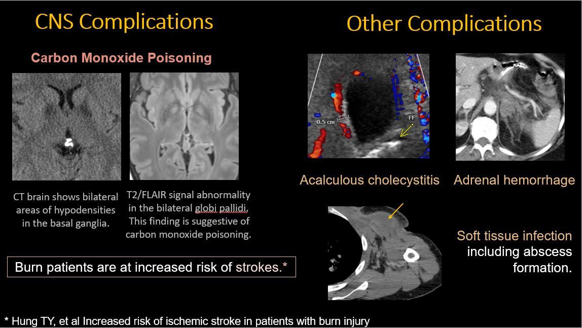 American Society of Emergency Radiology | ASER tweet media