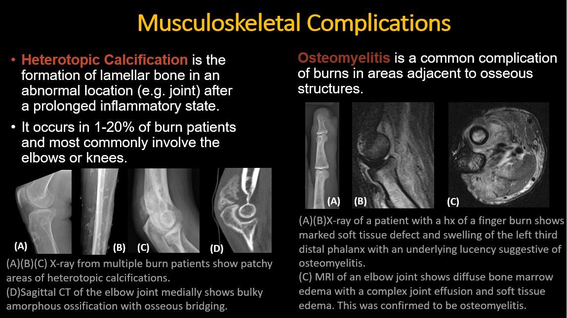American Society of Emergency Radiology | ASER tweet media