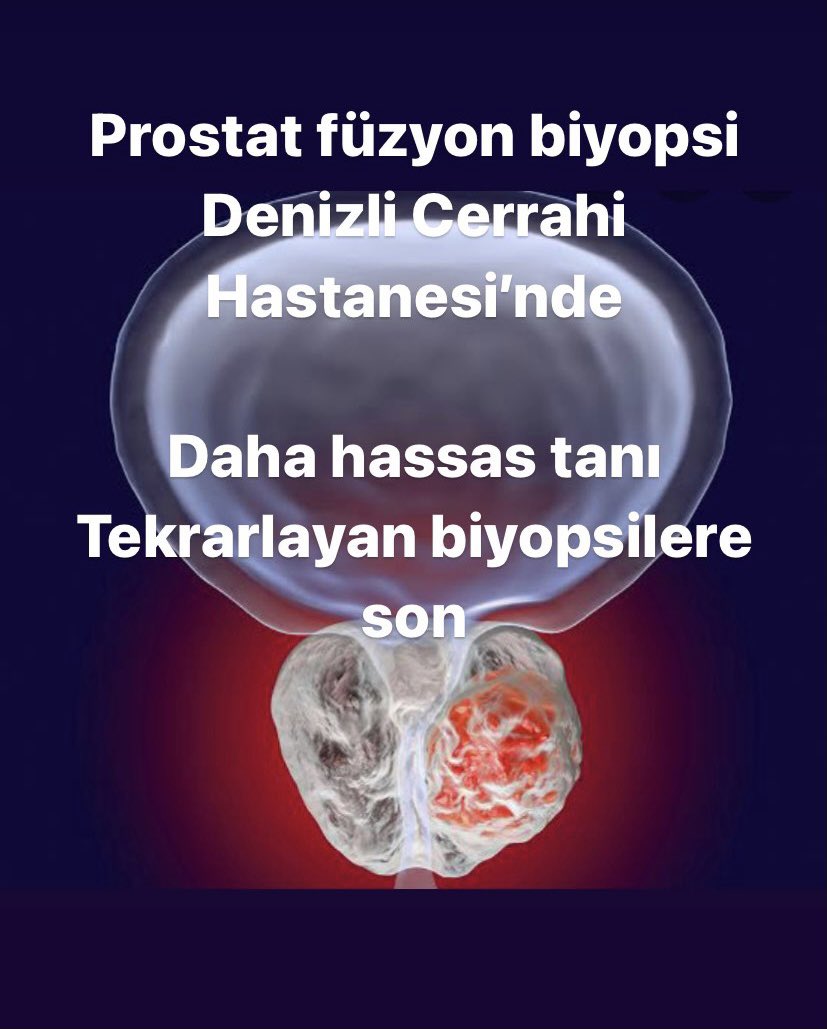 #prostatecancer #prostatefusionbiopsy