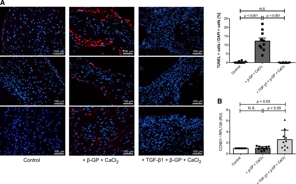 ajpheartcirc's tweet photo. #ImagesoftheWeek Transforming growth factor-β1 promotes fibrosis but attenuates calcification of valvular tissue applied as a three-dimensional calcific aortic valve disease model
https://t.co/G1WDzUfXsz
#CAVD #Calcification #Fibrosis #TGFB1 #3D https://t.co/bNpI07RnRY