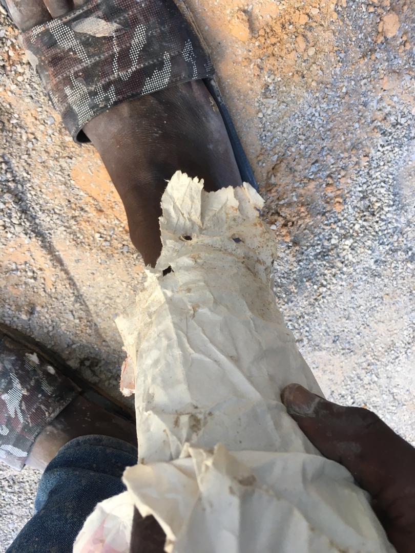 ZitelleArturo's tweet image. I #libici gli hanno sparato alla gamba mentre fuggiva in barca con altre persone. In ospedale lo hanno disinfettato e dato delle garze, ma delle garze lunghe per fasciare la ferita.
Come vedete copre la ferita con un foglio trovato per terra che alimenterà l'infezione.
👇