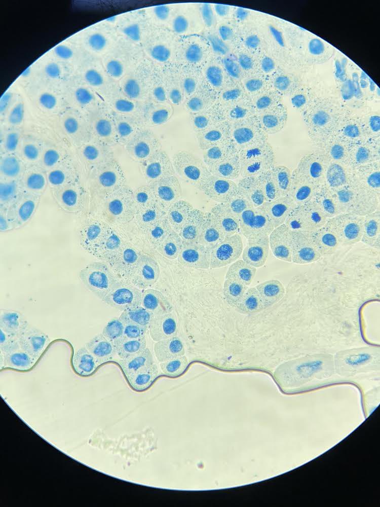 HPHighScience's tweet photo. Brilliant work by Y12 today! It is great to see them back in the lab, enjoying practical work. Required practical nailed! #HPHighScience #HPHighSixthForm #ALevelBiology #BrilliantBiology https://t.co/gg1UGtgEaj