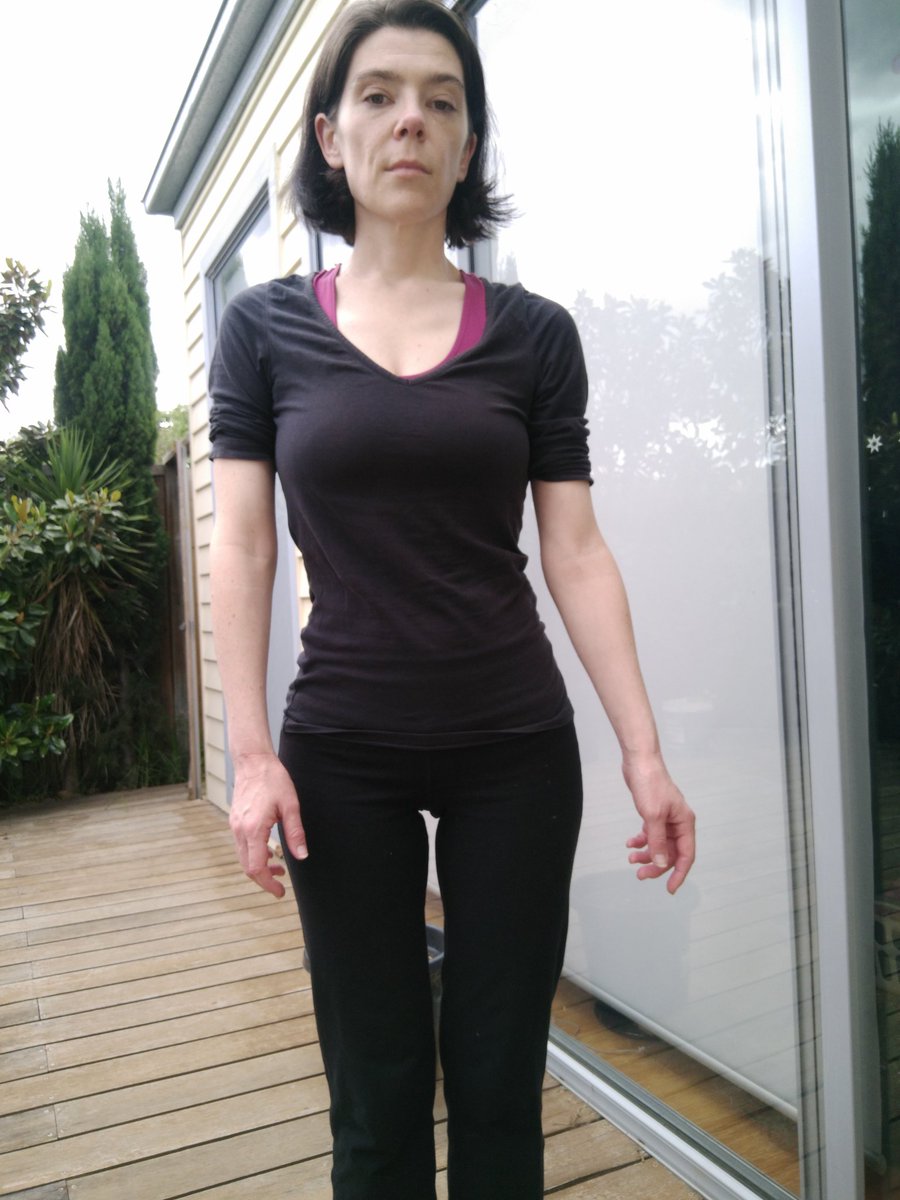 I'm losing my mind, it's destroying my mental health, I am SUFFERING and all they do is gaslight me by saying 'well that's very unusual, it lasts a week and gives good pain coverage'. Does this look like someone whose treatment is working to you