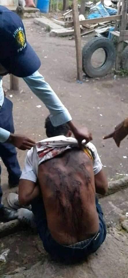 MuazAH15's tweet photo. Look at what the Ethiopian government is doing on our people.
When the world is celebrating wildlife rights, human beings are like this without any fault.@amnesty @UNHumanRights @hrw @UN @JoeBiden @TakeleUma @ukhomeoffice @keithellison https://t.co/izmgTKCnRV