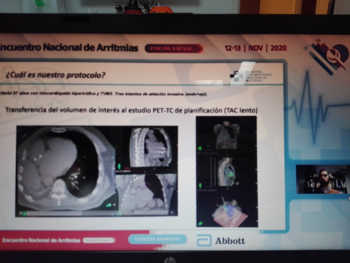 Consejo de Arritmias SAC tweet media