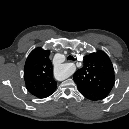 Darel Heitkamp, MD tweet media