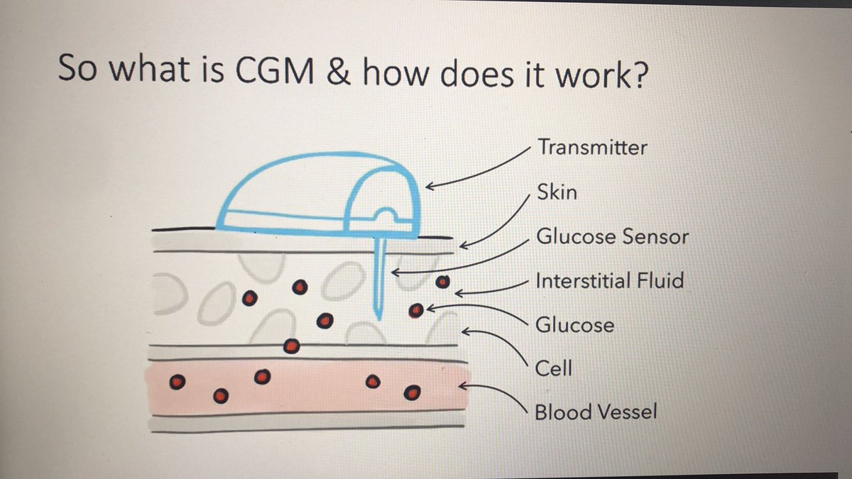 Moodwife's tweet photo. Onto Session 2 and a revision of the purpose of and journey into providing #CGM #FlashGM #UTD2020 https://t.co/IkdpFRL8Xt