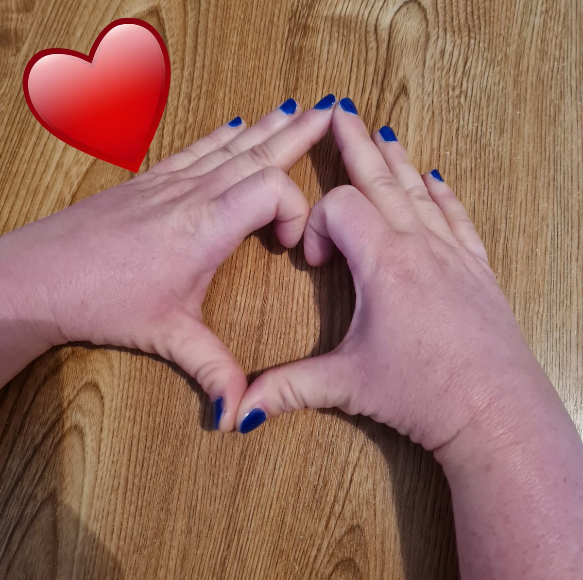 My diabuddie <a href="/fatface1987/">Bekki</a> #nailingdiabetes 💙 #alltogether #WorldDiabetesDay