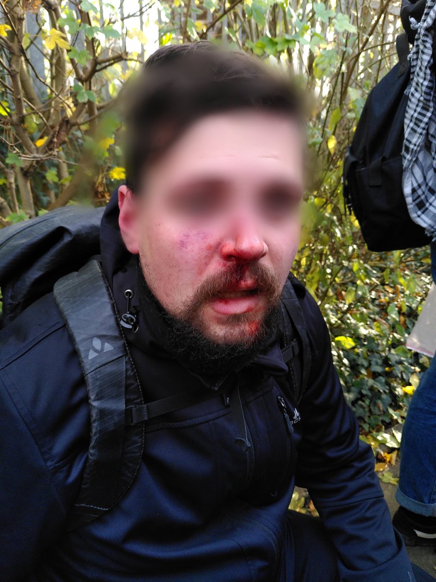 BlockZHG's tweet image. So sieht die Polizeitaktik in Remagen aus!
Bullen prügeln Naziaufmarsch an uns vorbei und hinterlassen mehrere Verletzte
#RemagenNazifrei #rmg1411 #BlockZHG