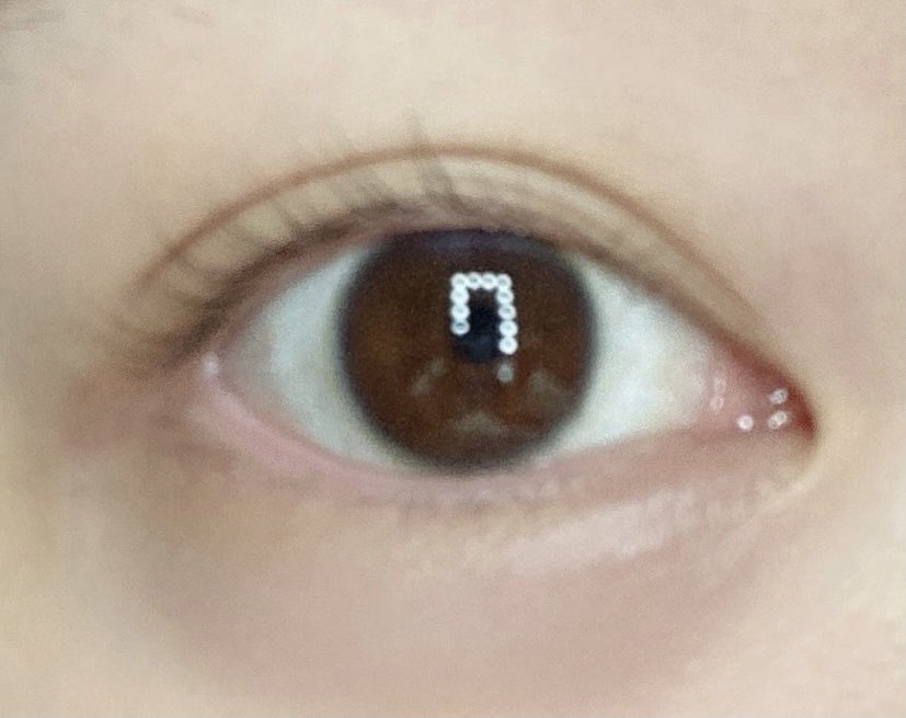 ট ইট র きゃりーぱみゅぱみゅ 先日iclを受けました 視力も悪くて乱視も酷くてずっとずっと悩んでいたんだけど 手術を受けて次の日から両目が2 0に 色鮮やかでなにより朝起きてすぐ見えて感動してる 時間が経てばまた カラコンも付けれるみたいで嬉しい